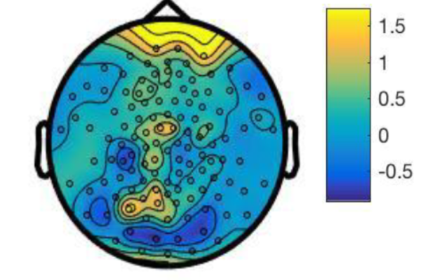 Brain scan with highlighted regions